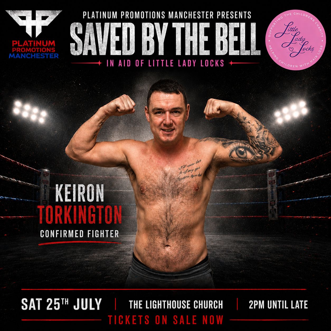 Keiron Torkington